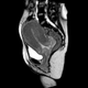 Illustration for article titled Bonus: Stills Of The MRI Live Birth